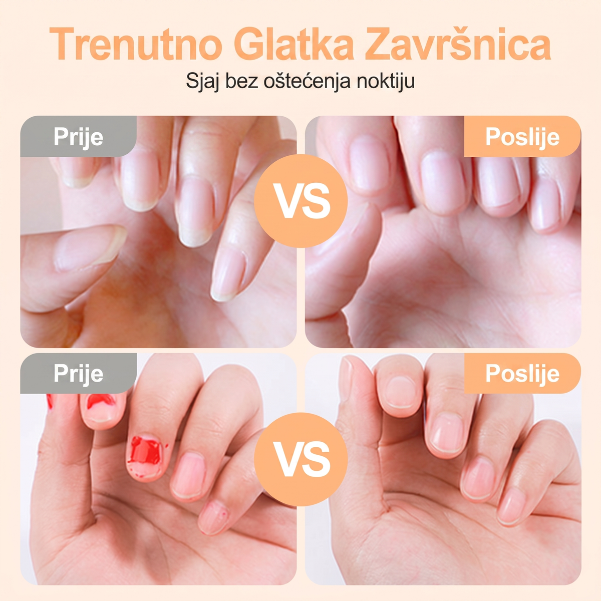 👑👑Vremenski ograničena ponuda⏰Pametni električni trimer i polirač za nokte 2 u 1 za sve uzraste 👨‍👩‍👧‍👦 – Njega noktiju bez oštrica, bez krvi i bez stresa! 💅