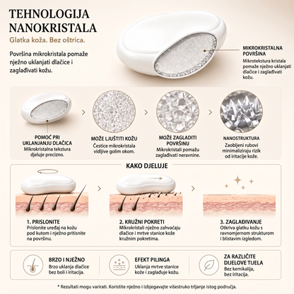 Vitalisys® Kristalni epilator za tijelo – Glatka koža bez britvice i voska 💎