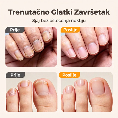 👑👑Vremenski ograničena ponuda⏰Pametni električni trimer i polirač za nokte 2 u 1 za sve uzraste 👨‍👩‍👧‍👦 – Njega noktiju bez oštrica, bez krvi i bez stresa! 💅